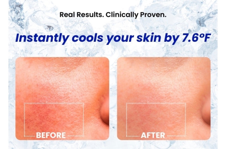 Varol ice roll serum con bakuchiol