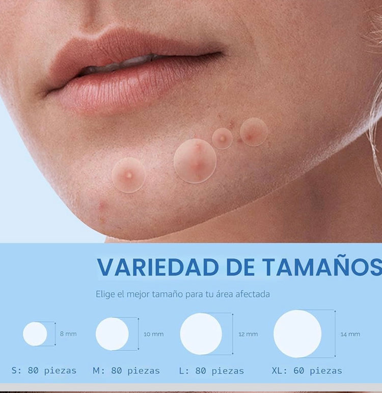 Daolyo parches anti acné 300 unidades
